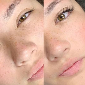 NaturalGrowth™ Kit Serum 2 unidades: pestañas largas y fuertes