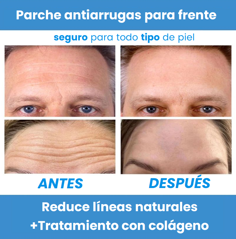 🌿 SkinLift™ Parches de Colágeno Absorbentes
