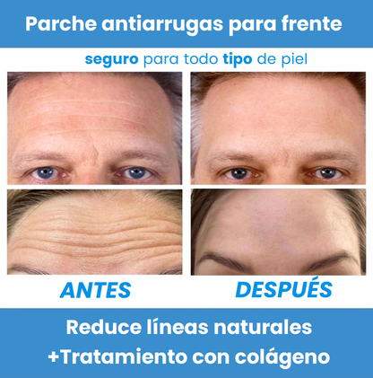 🌿 SkinLift™ Parches de Colágeno Absorbentes