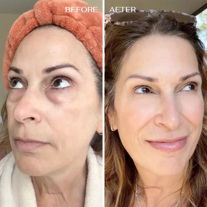 ✨ DermaKit™ Parches de Colágeno Absorbente (Ojeras)