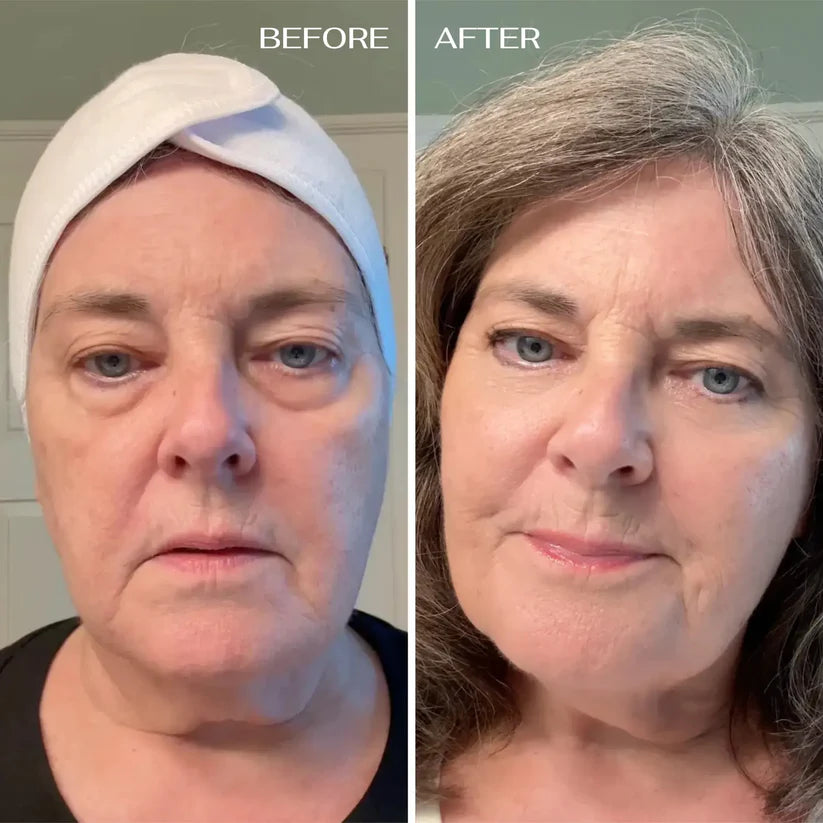 ✨ DermaKit™ Parches de Colágeno Absorbente (Ojeras)